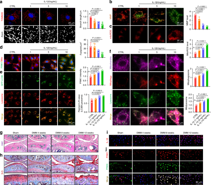 SIRT3-PINK1-PKM2 axis prevents osteoarthritis via mitochondrial renewal and metabolic switch