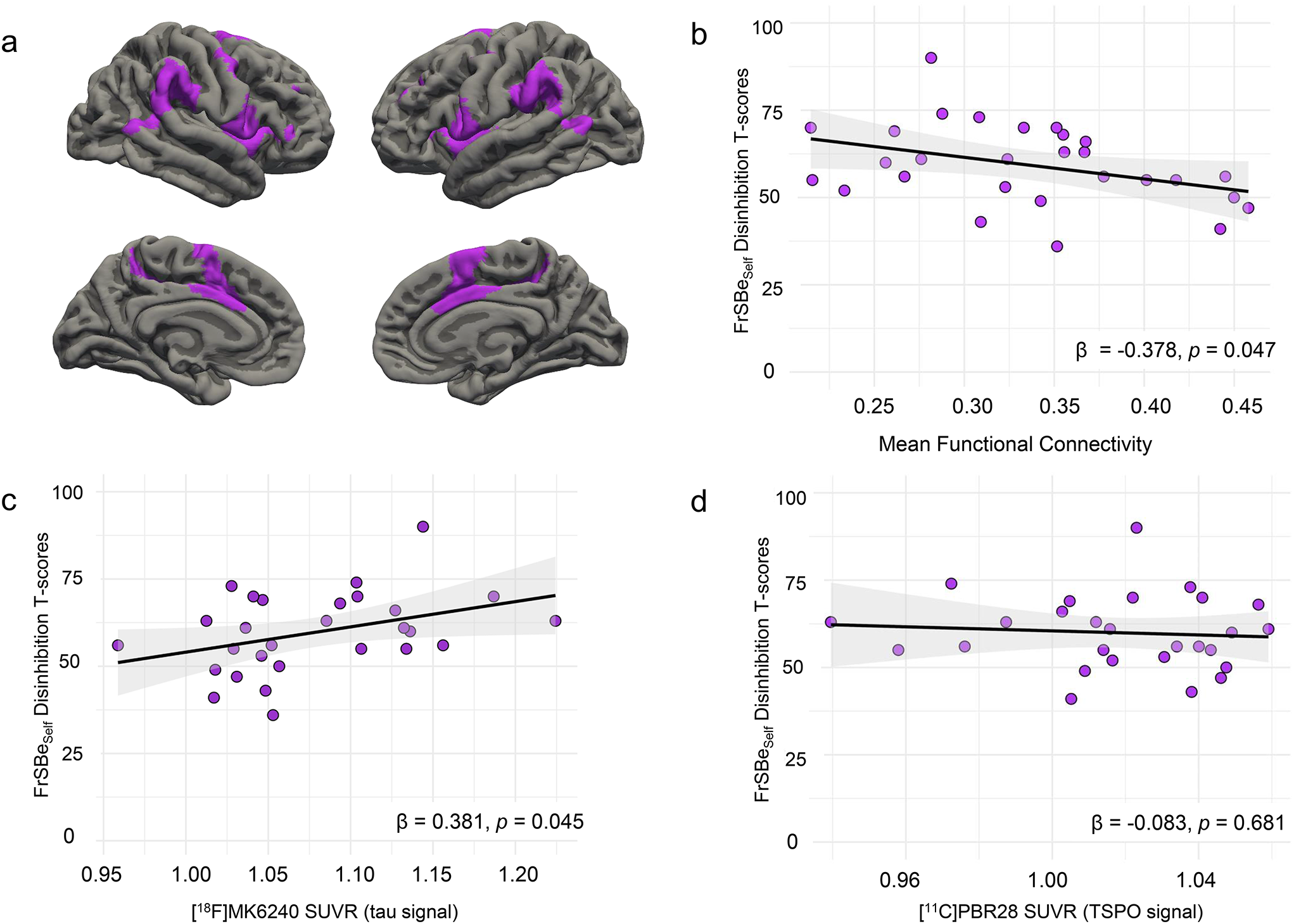 Investigating the neural network correlates of apathy, disinhibition, and executive dysfunction in active-duty United States Special Operations Forces