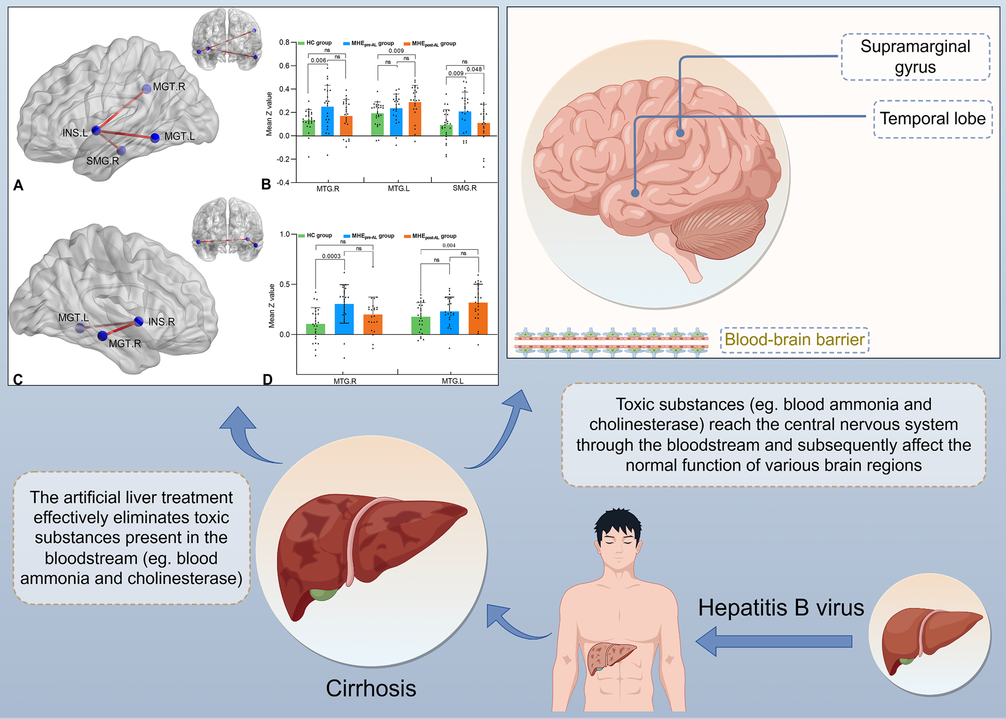 The neuroprotective power of artificial liver therapy: reversing cognitive impairment in minimal hepatic encephalopathy