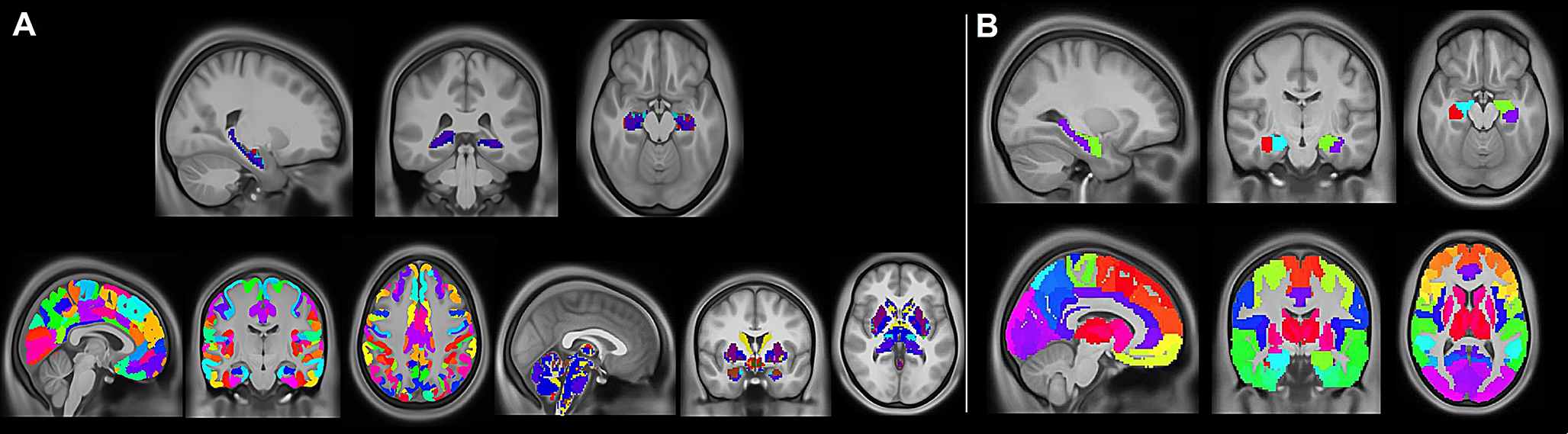 Hippocampal network connectivity and episodic memory in individuals aging with traumatic brain injury