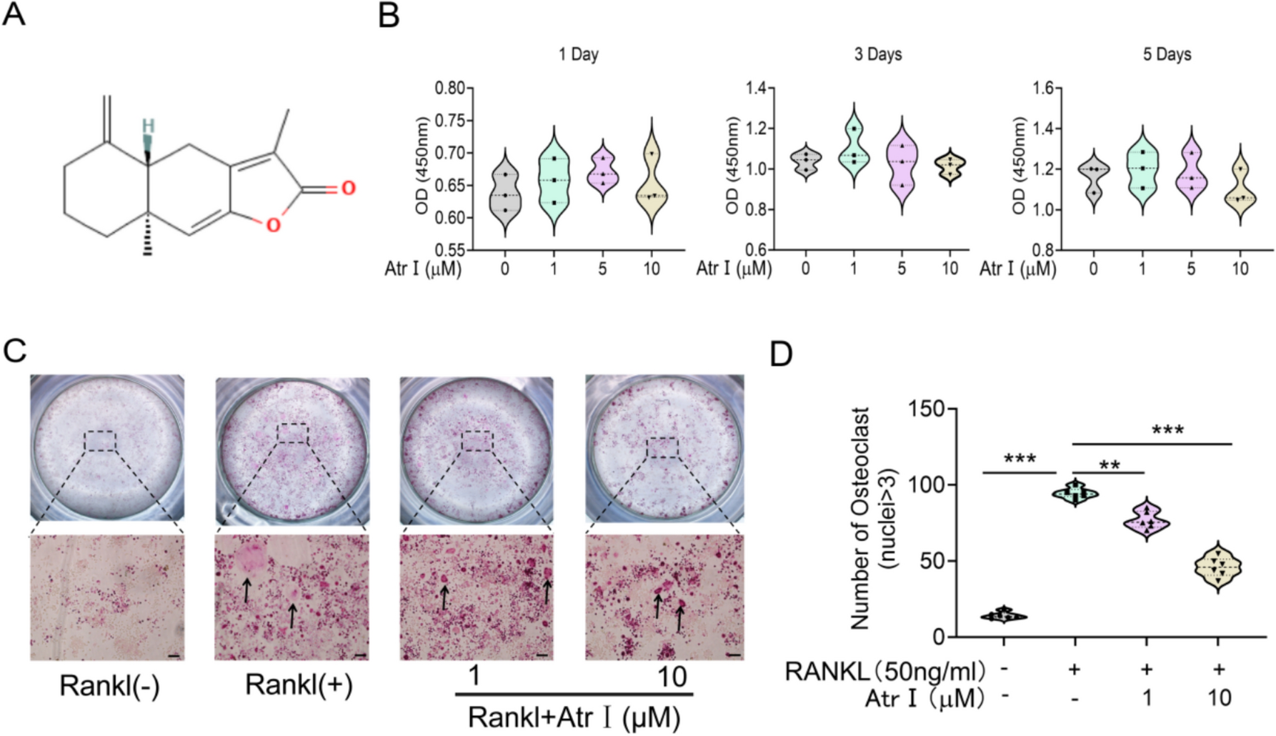 Atractylenolide I Attenuates Glucocorticoid-Induced Osteoporosis via Inhibiting NF-κB Signaling Pathway