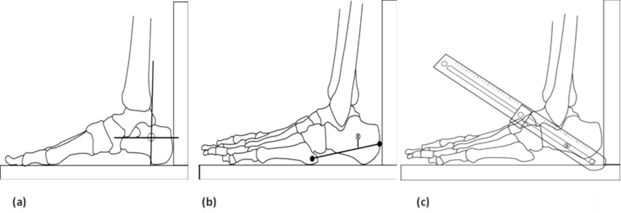 Calcaneal Ultrasound Attenuation: Does the Region of Interest and Loading Influence the Repeatability of Measurement?