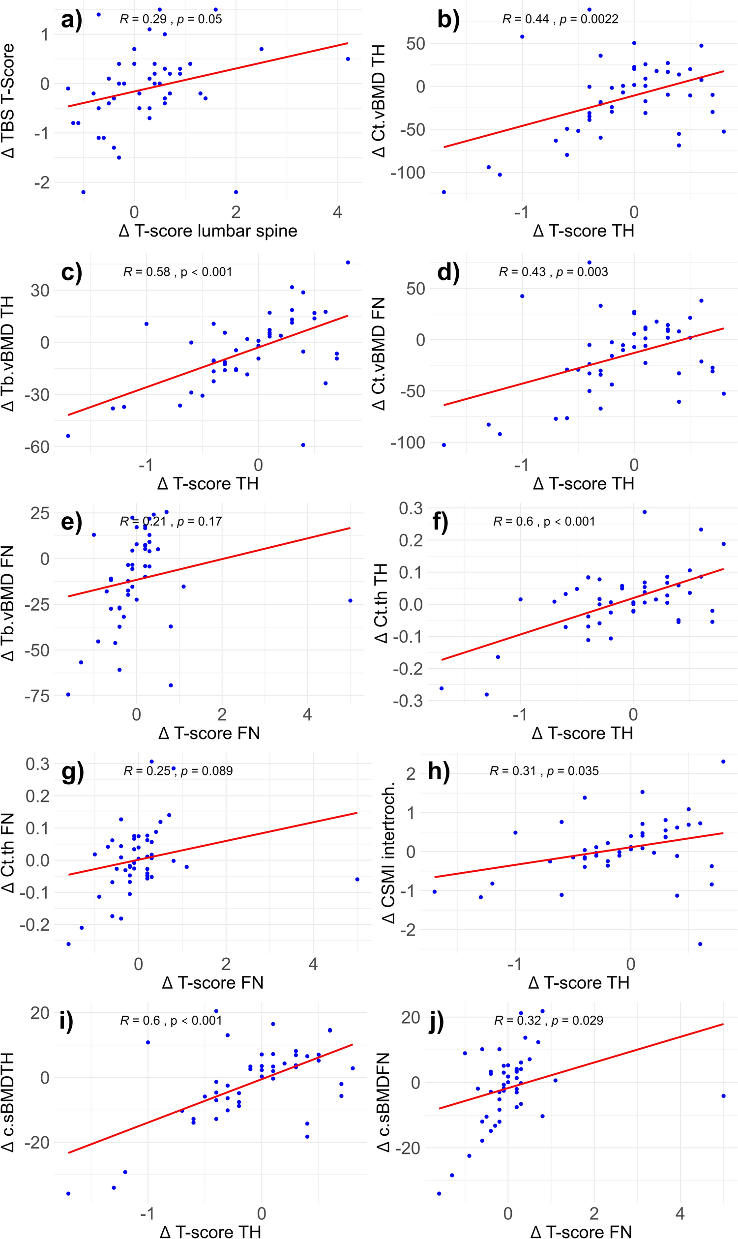 Long-Term Changes in Parameters of Bone Quality in Kidney Transplant Recipients Treated with Denosumab