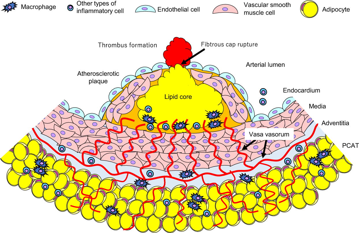 Pericoronary adipose tissue: potential for pathological diagnosis and therapeutic applications