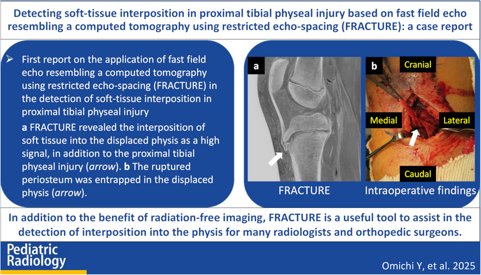 Detecting soft-tissue interposition in proximal tibial physeal injury based on fast field echo resembling a computed tomography using restricted echo-spacing (FRACTURE): a case report