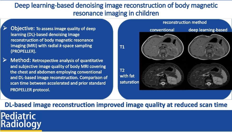 Deep learning-based denoising image reconstruction of body magnetic resonance imaging in children