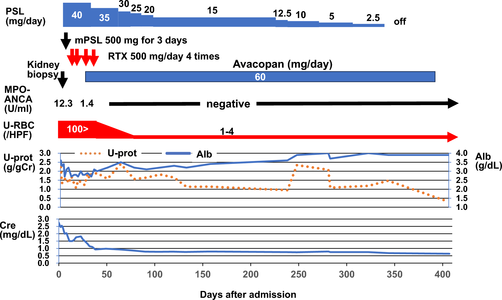 Successful treatment of MPO-ANCA positive crescentic IgA nephropathy/IgA vasculitis with nephritis potentially triggered by a COVID-19 vaccine in a young adult female using corticosteroids, rituximab, and avacopan