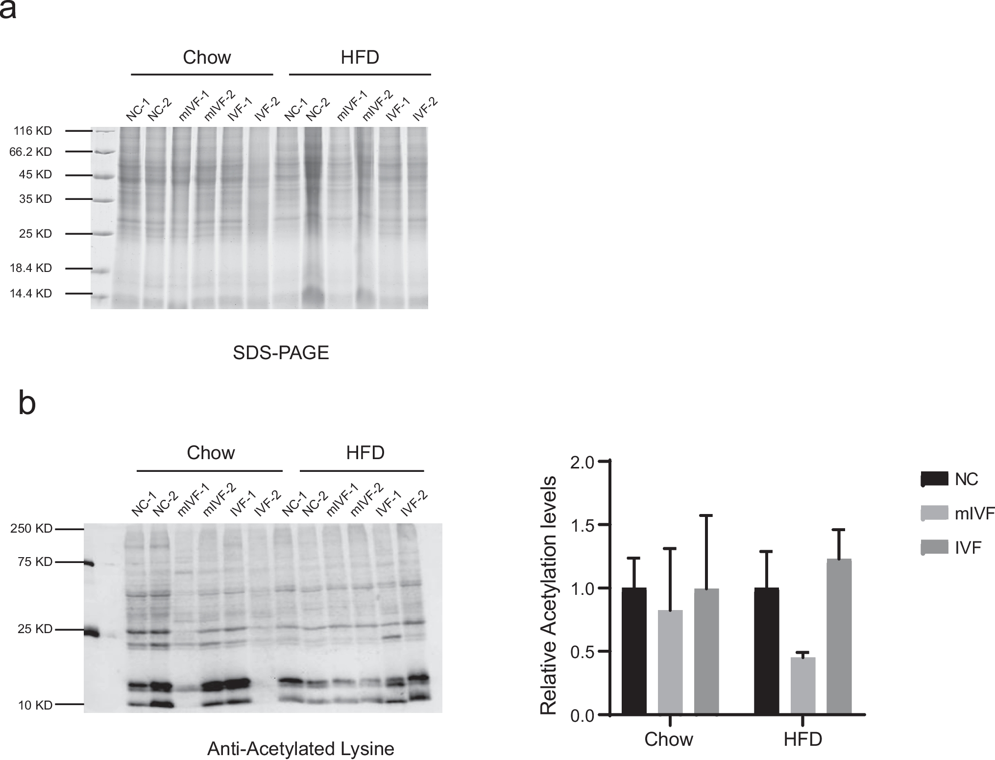 Melatonin Rescues Hyperacetylation of Liver and Impaired Enzymatic Activities of Mitochondrial in IVF Offspring