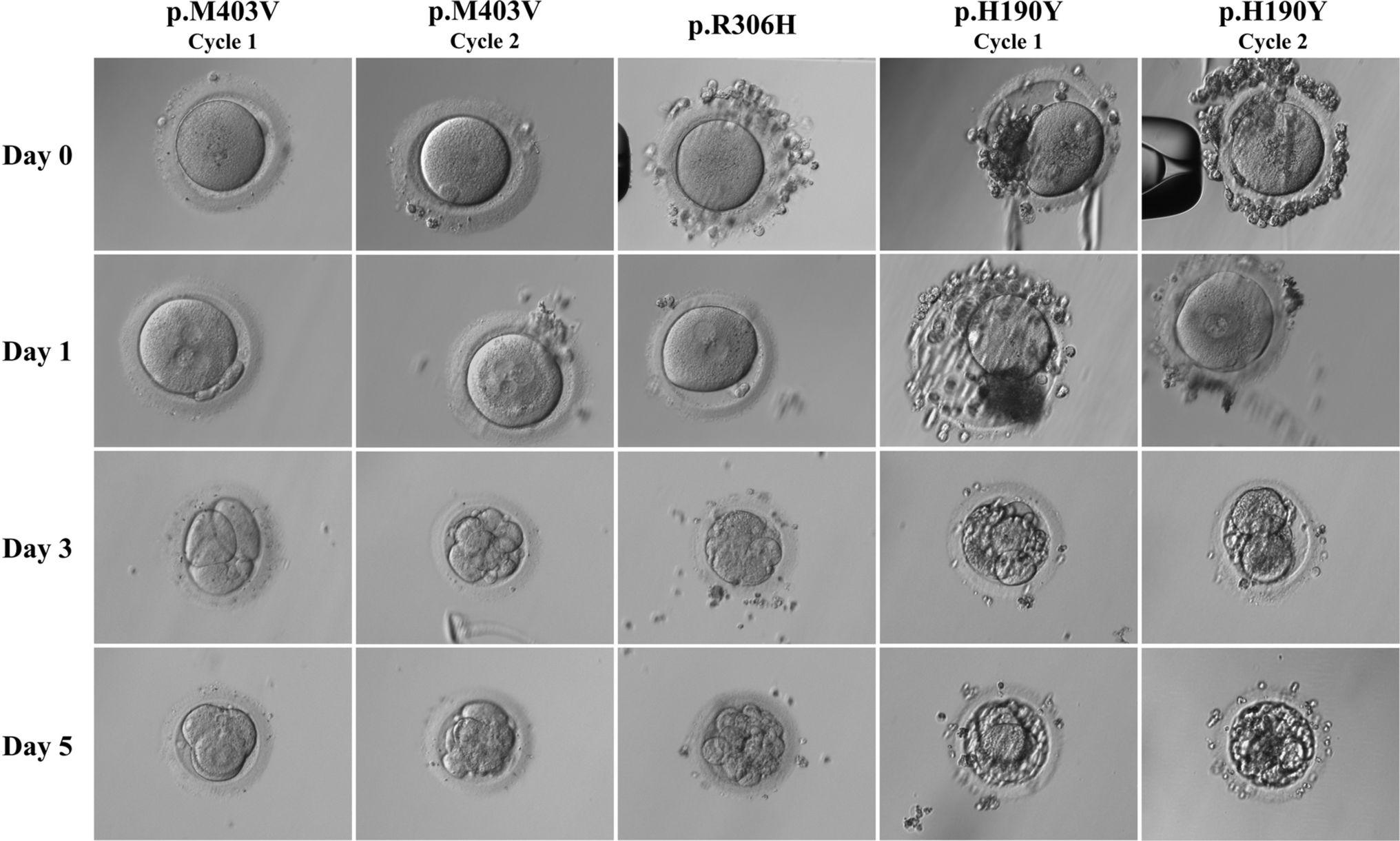 Three Novel Mutations in TUBB8 Cause Female Infertility Due to Multiple Morphological Abnormalities of the Oocyte and Early Embryo
