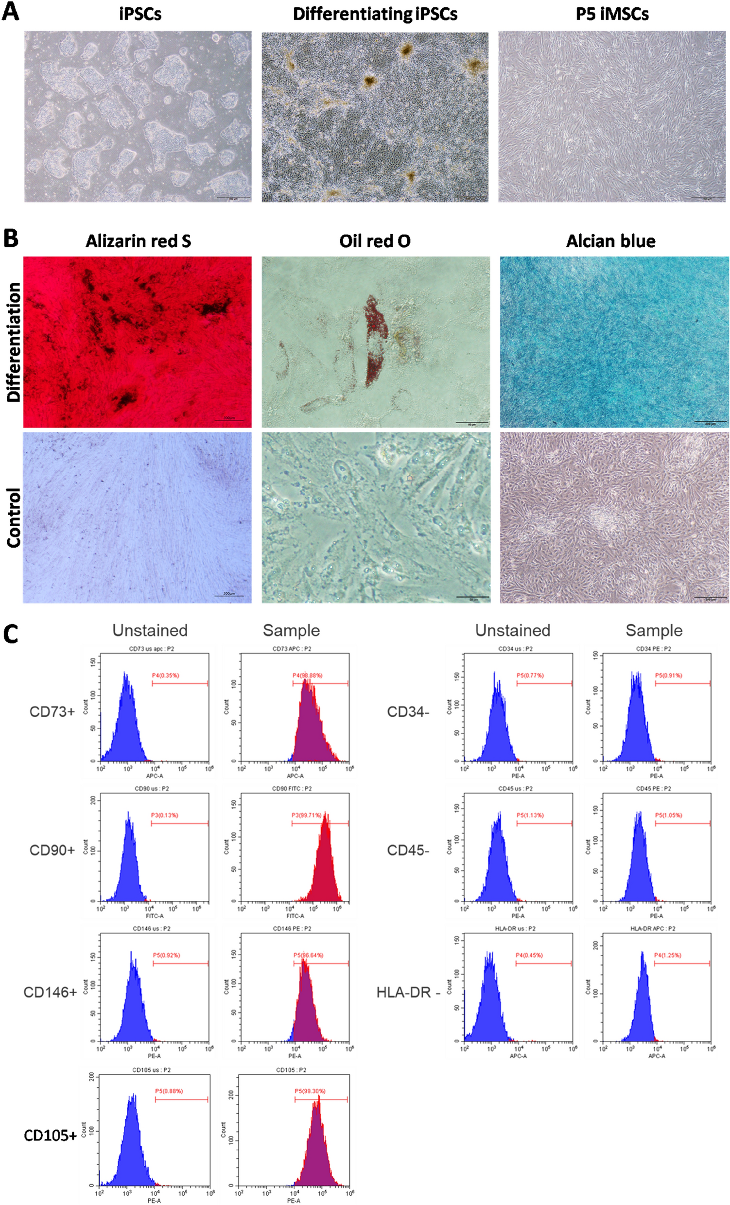 Induced pluripotent stem cell-derived mesenchymal stem cells (iMSCs) inhibit M1 macrophage polarization and reduce alveolar bone loss associated with periodontitis