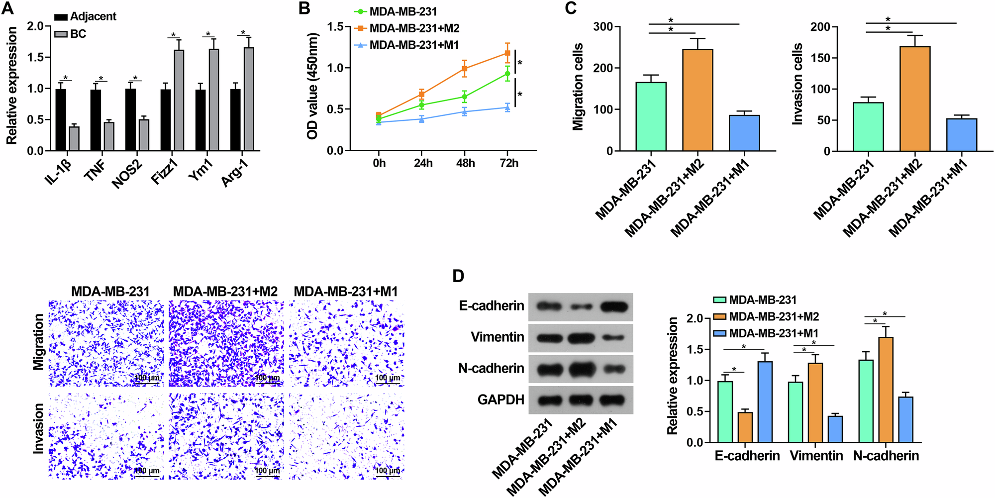 Macrophage Polarization-Based Analysis of the Role of the FOXM1/KIF20A Axis in Breast Cancer Metastasis