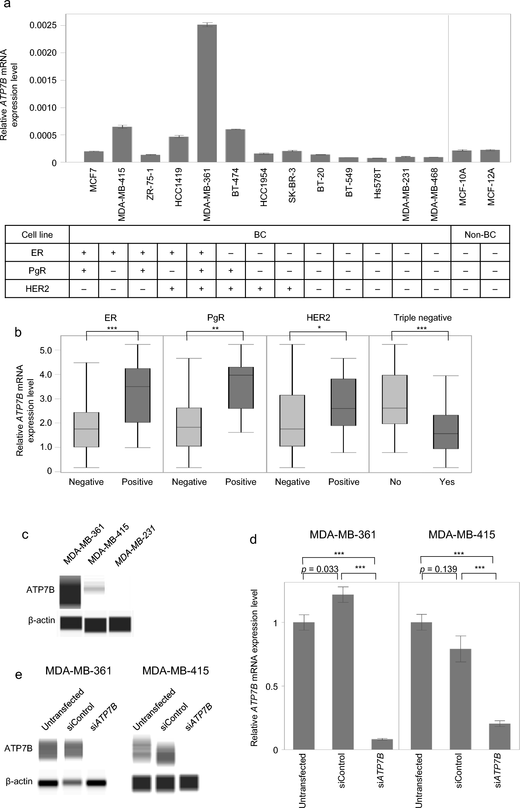 ATPase copper transporting beta attenuates malignant features with high expression as an indicator of favorable prognosis in breast cancer