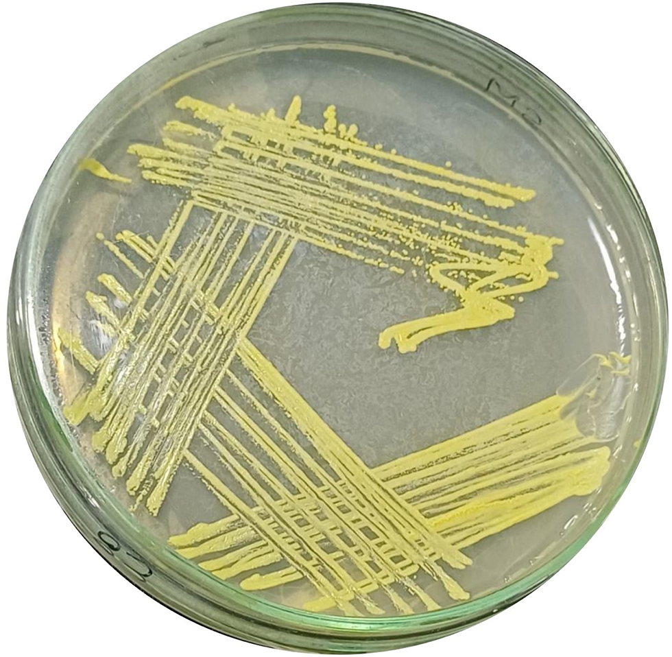 -derived biosurfactants as eco-friendly biocontrol agent with broad-spectrum antibacterial and antifungal properties for sustainable applications