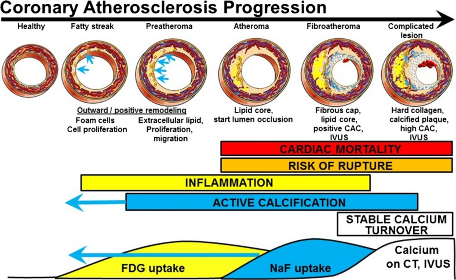 Reproducibility of F-Sodium Fluoride Positron Emission Tomography for Assessing Microcalcification in Coronary Arterial and Thoracic Aortic Atherosclerosis: Is the Signal below the Resolution of PET?