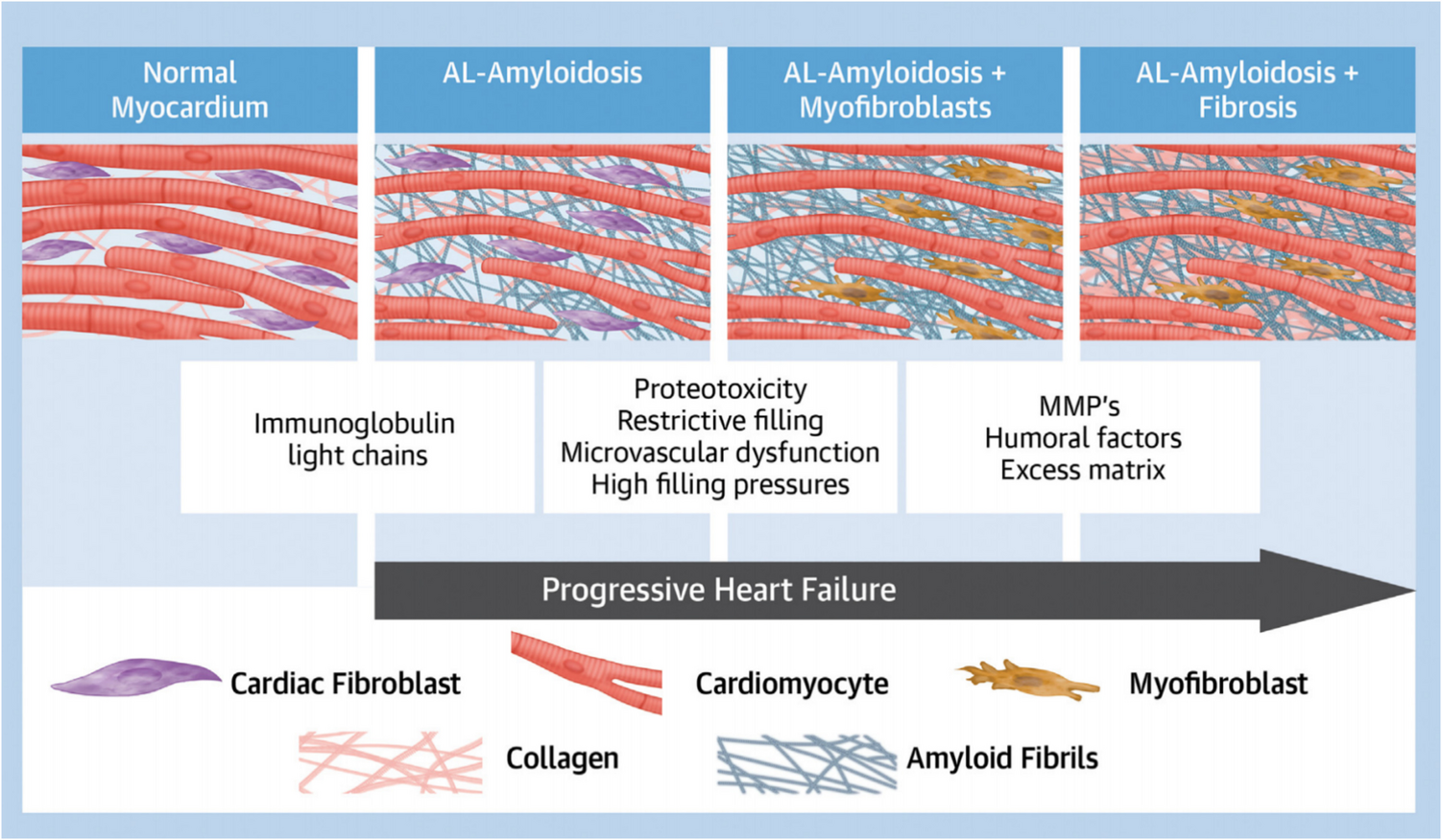 Ga-FAPI-04 PET/CT for the Assessment of Light-Chain Cardiac Amyloidosis: A Promising Risk- Stratification Imaging Modality