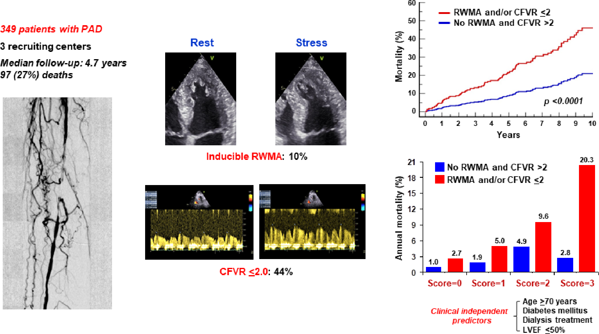 Prognostic significance of coronary flow velocity reserve in patients with peripheral arterial disease