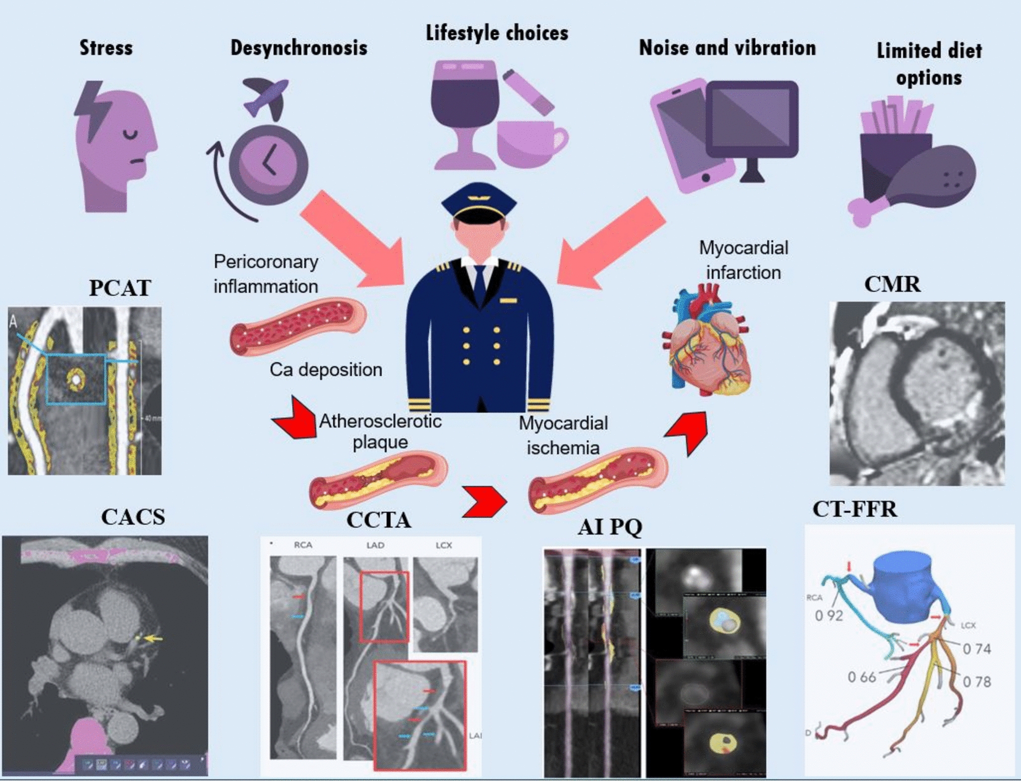 Impact of the recent advances in coronary artery disease imaging on pilot medical certification and aviation safety: current state and future perspective