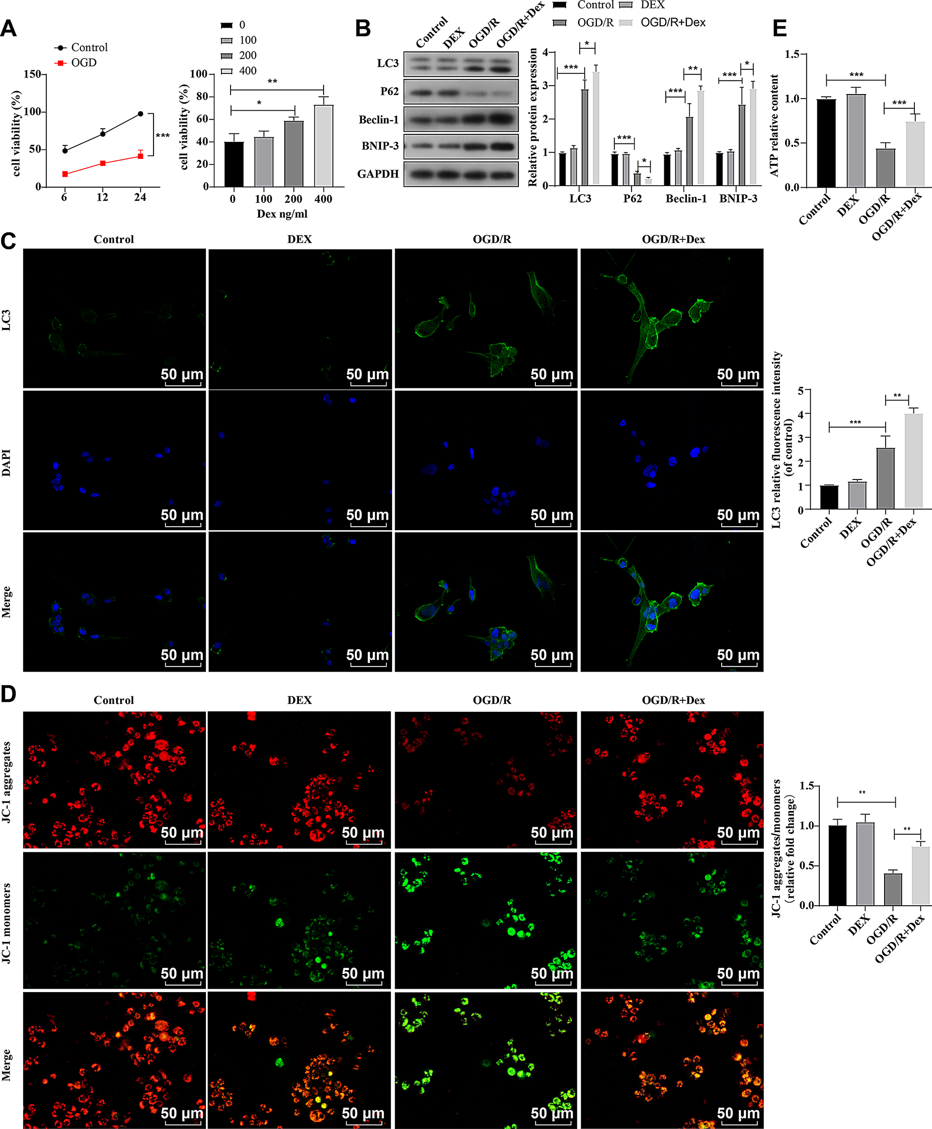 Dexmedetomidine activates mitophagy and protects against pyroptosis in oxygen-glucose deprivation/reperfusion-induced brain damage  PINK1/Parkin pathway activation