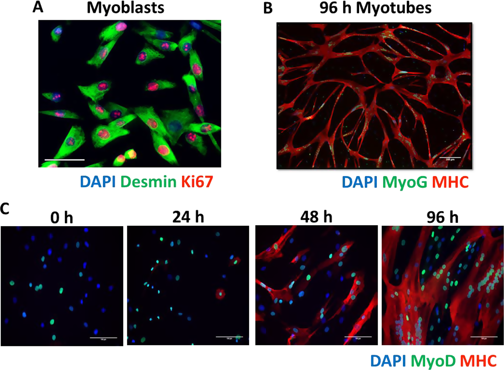Insights into human muscle biology from human primary skeletal muscle cell culture