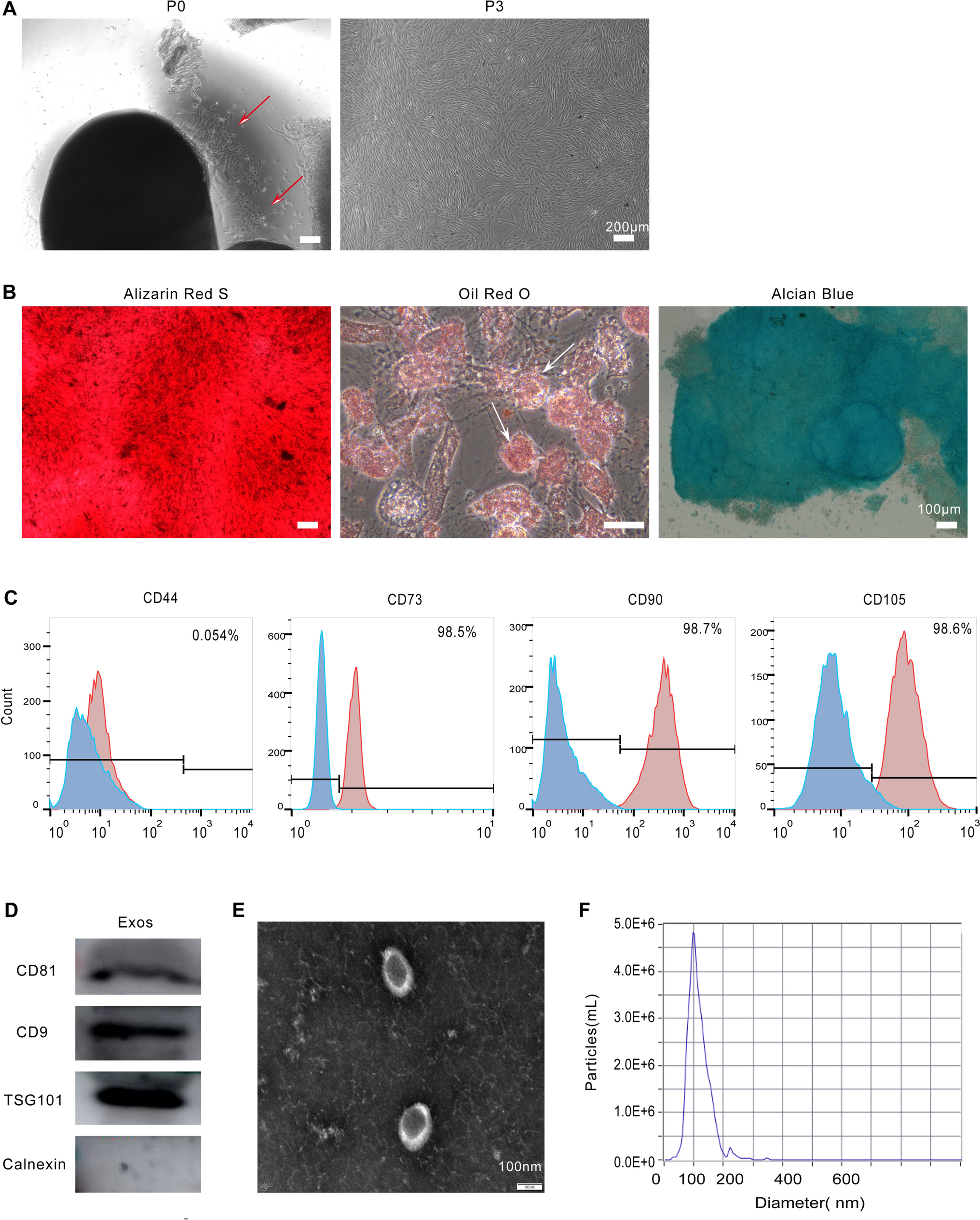 Exosomes Extracted from Human Umbilical Cord MSCs Contribute to Osteoarthritic Cartilage and Chondrocytes Repair Through Enhancing Autophagy  While Suppressing the Wnt/β-Catenin Pathway
