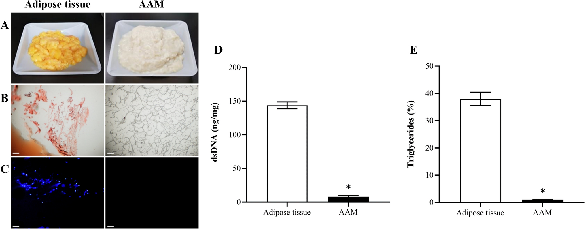 Injectable Human Acellular Adipose Matrix with Crosslinked Hyaluronic Acid and Carboxymethyl Cellulose Gels for Soft Tissue Augmentation