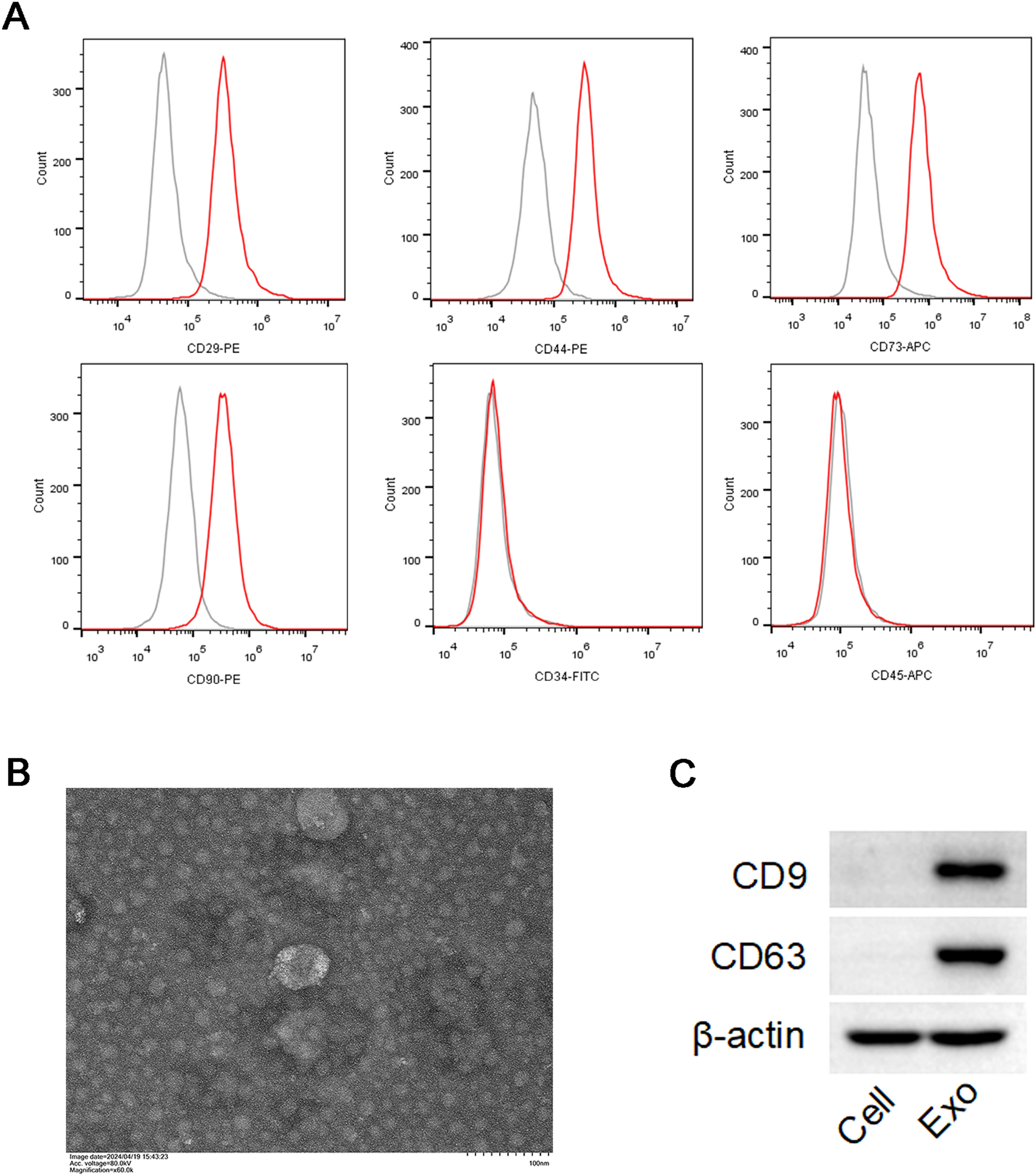 Mesenchymal stem cell exosomes regulate TGFβ/Smad3 by decreasing the METTL3-NEAT1 axis to inhibit scar progression after breast surgery
