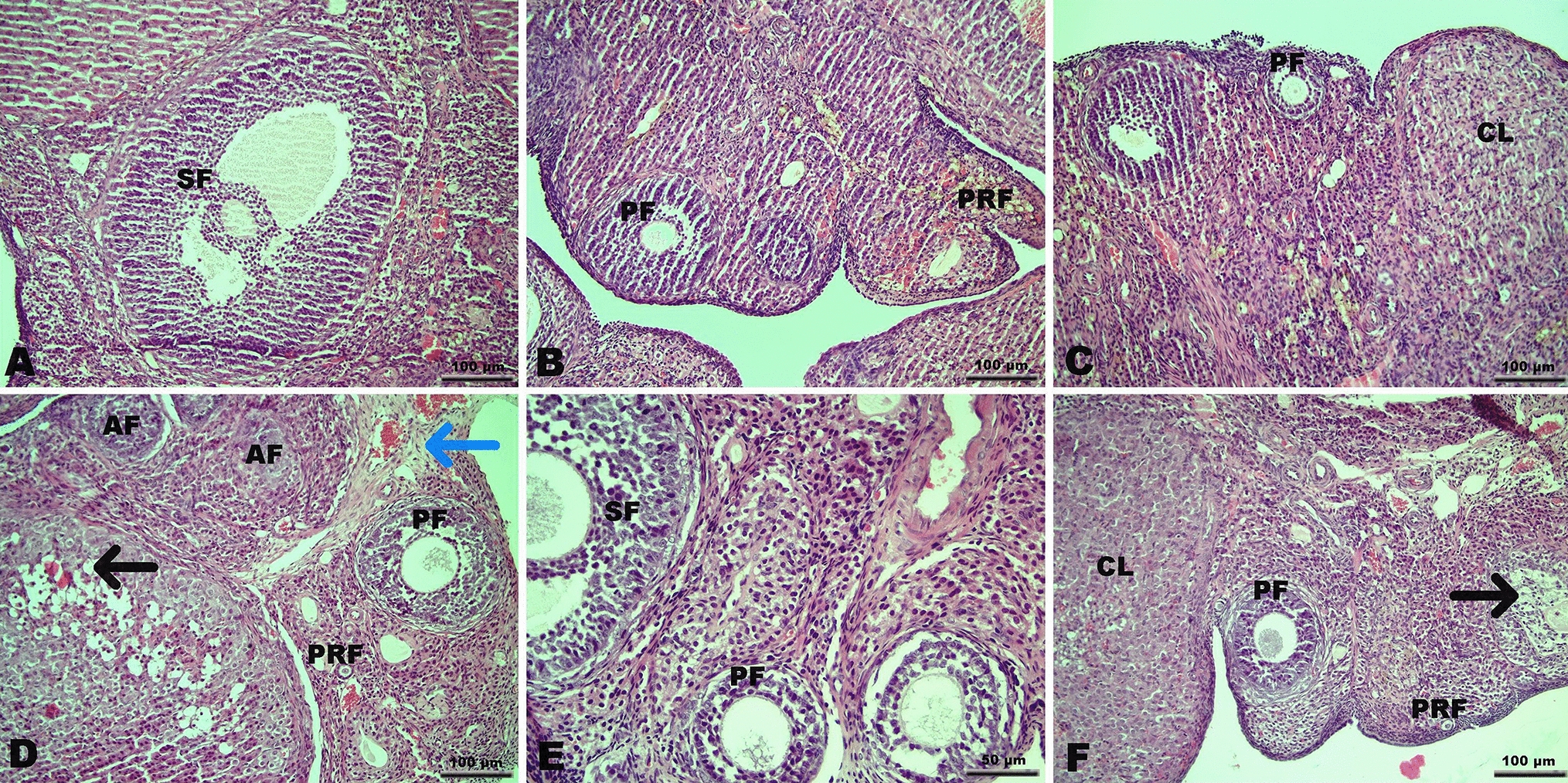 Effect of autologous cytokine-rich serum and platelet-rich plasma administration on oxidative status, minerals and proinflammatory cytokines in brain and serum in cyclophosphamide-induced ovarian failure
