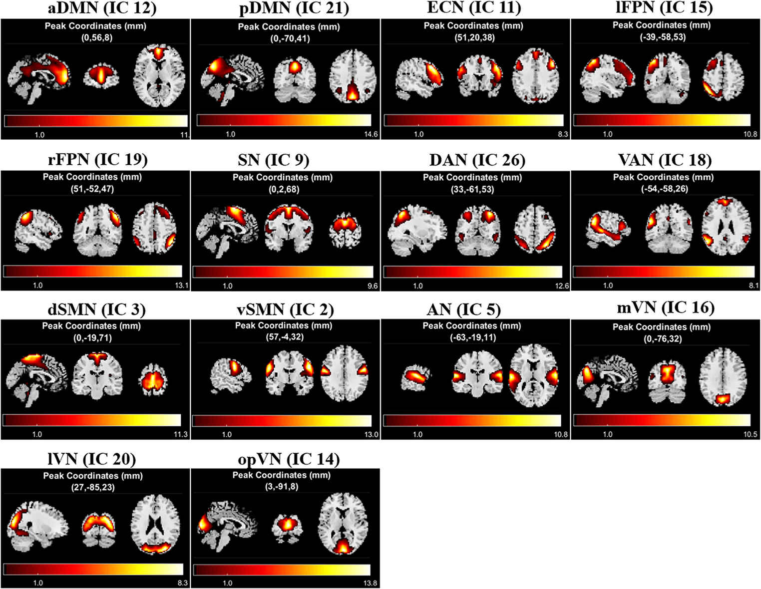 Disrupted static and dynamic Large-scale brain functional network connectivity in the differentiation of myelin oligodendrocyte glycoprotein Antibody-Seropositive from seronegative optic neuritis