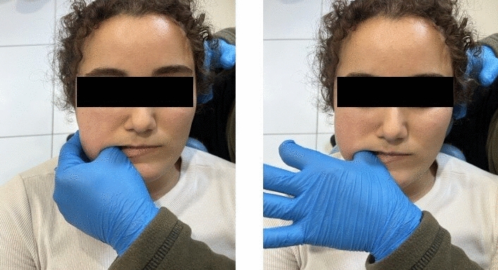 Immediate and short-term effect of manual therapy on masseter muscle: an ultrasonography study