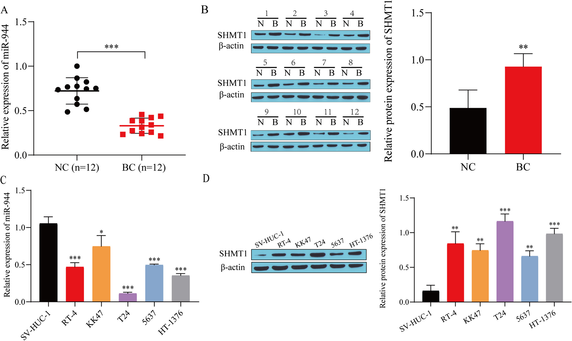 miR-944 inhibits malignant progression of bladder cancer through ATIC/AKT/FOXO3 A axis mediated by SHMT1