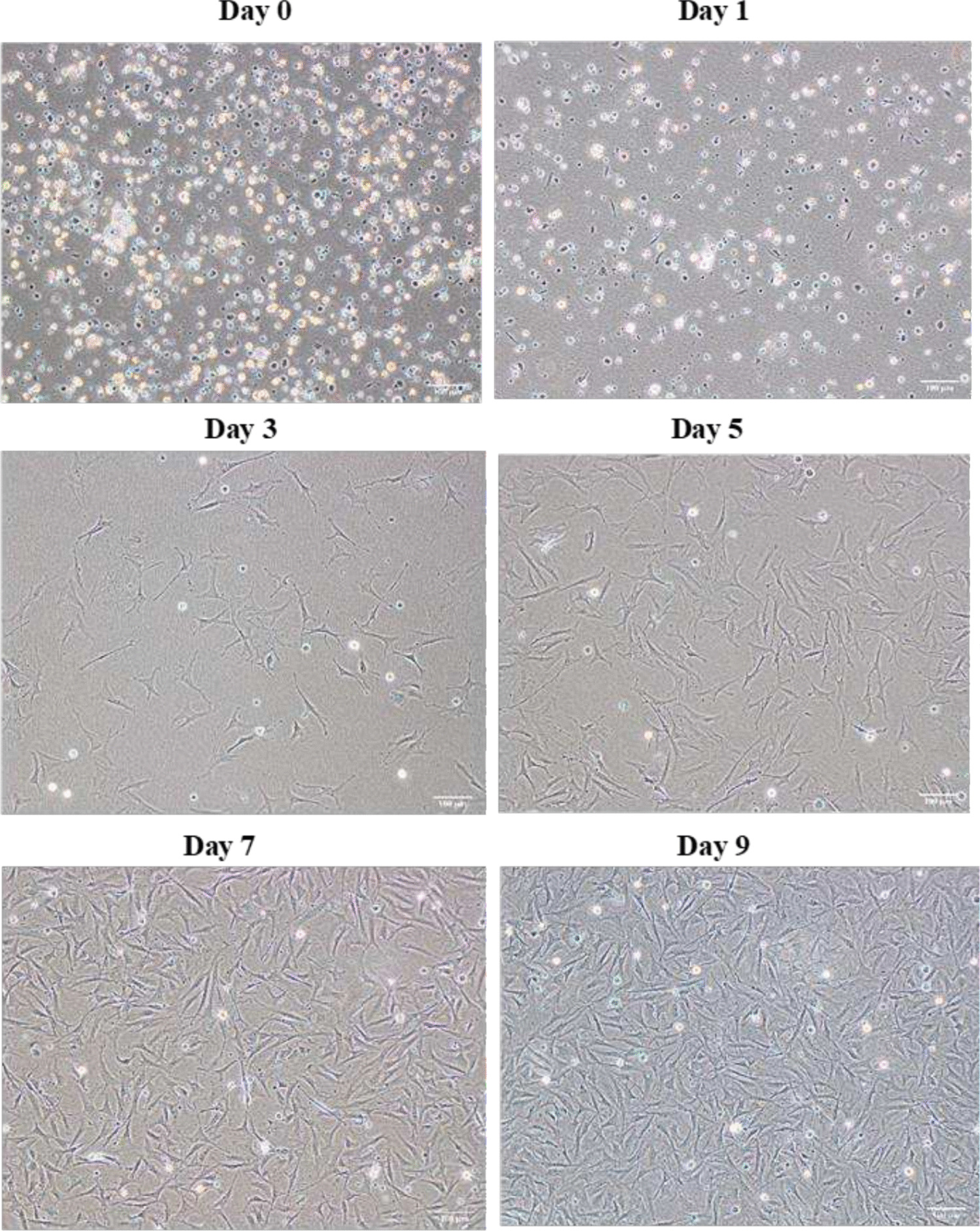 Development and characterization of red seabream () muscle satellite cell lines for cultivated seafood: highlighting serum reduction and microcarrier expansion