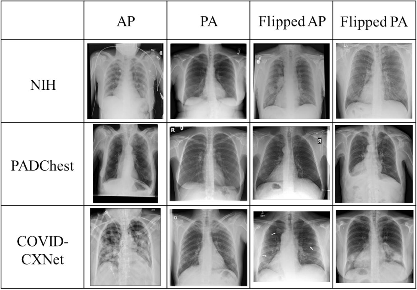 Generalizable AI approach for detecting projection type and left–right reversal in chest X-rays
