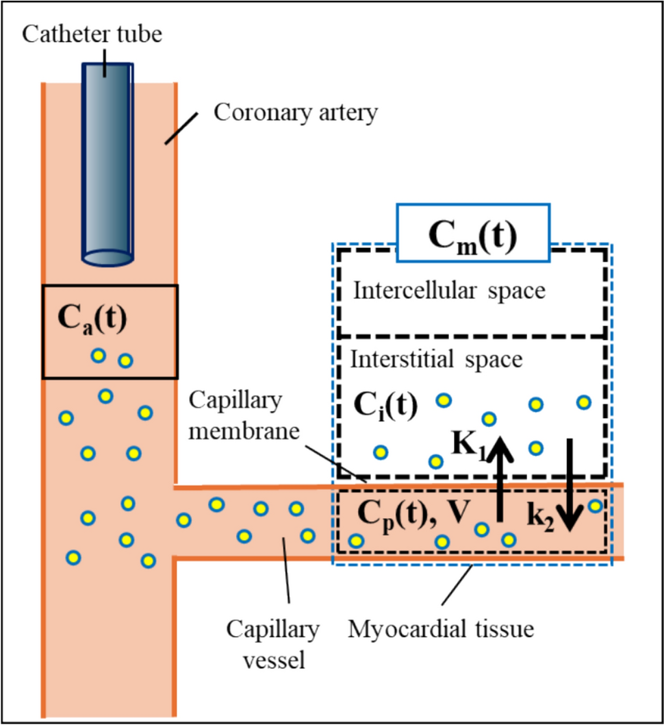 Development of myocardial perfusion imaging from coronary angiography for clinical application