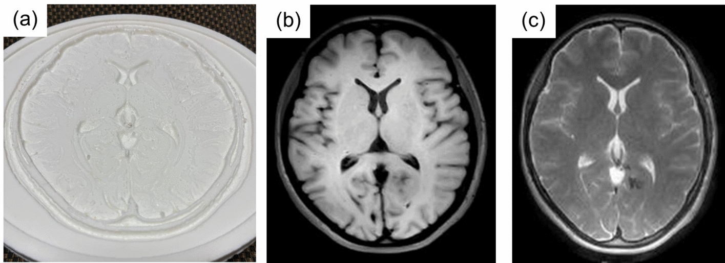 Comparison of image quality evaluation methods for magnetic resonance imaging using compressed sensing–sensitivity encoding (CS-SENSE)