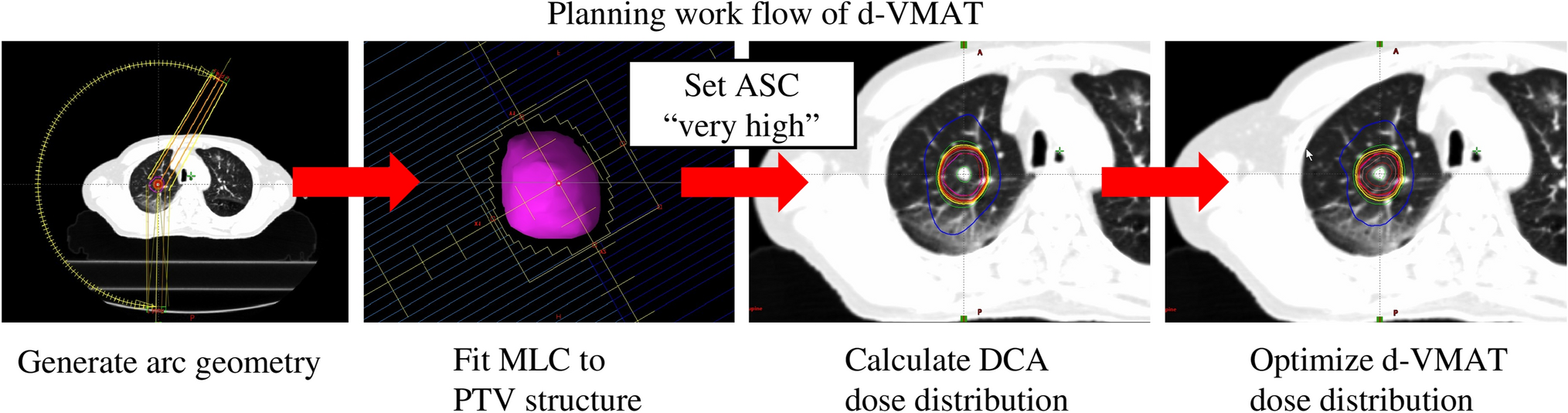 Comprehensive plan quality assessment of simplified volumetric-modulated arc therapy for lung stereotactic body radiotherapy