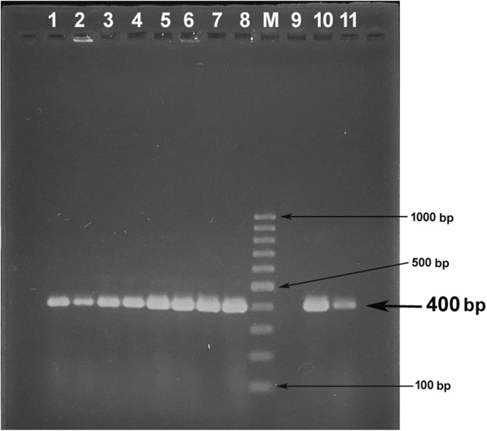 Virulence potential of sensu lato group bacteria isolated from green leafy vegetables