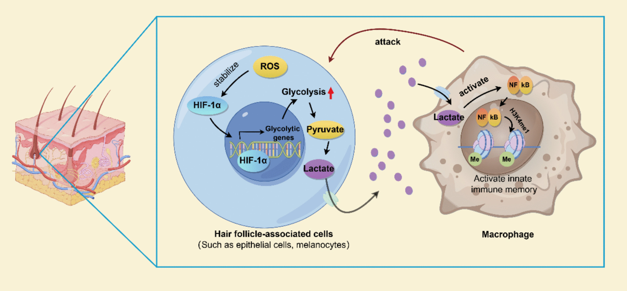 Macrophage-Centric Immunometabolic Crosstalk in Alopecia Areata Pathogenesis: Mechanisms and Therapeutic Implications
