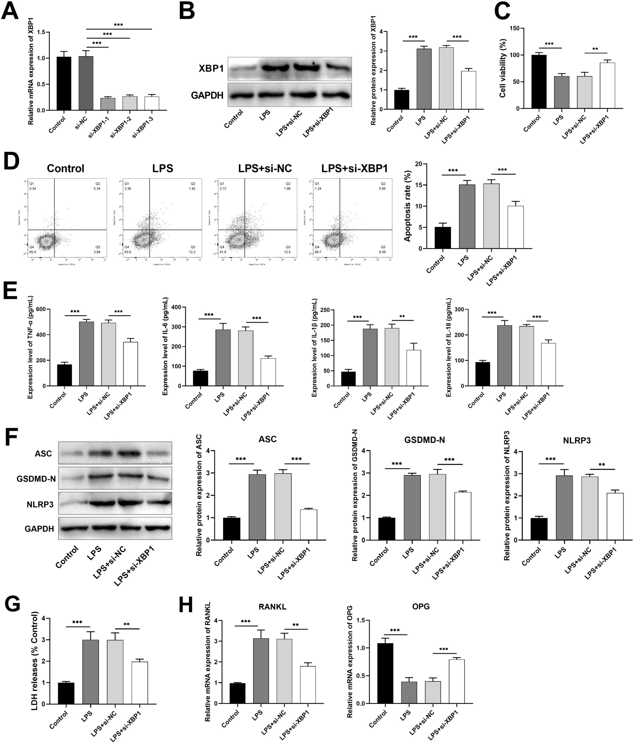 XBP1 Knockdown Alleviates Pyroptosis and Promotes Th17/Treg Imbalance in Periodontitis by Inhibiting the IL-17 Signaling Pathway