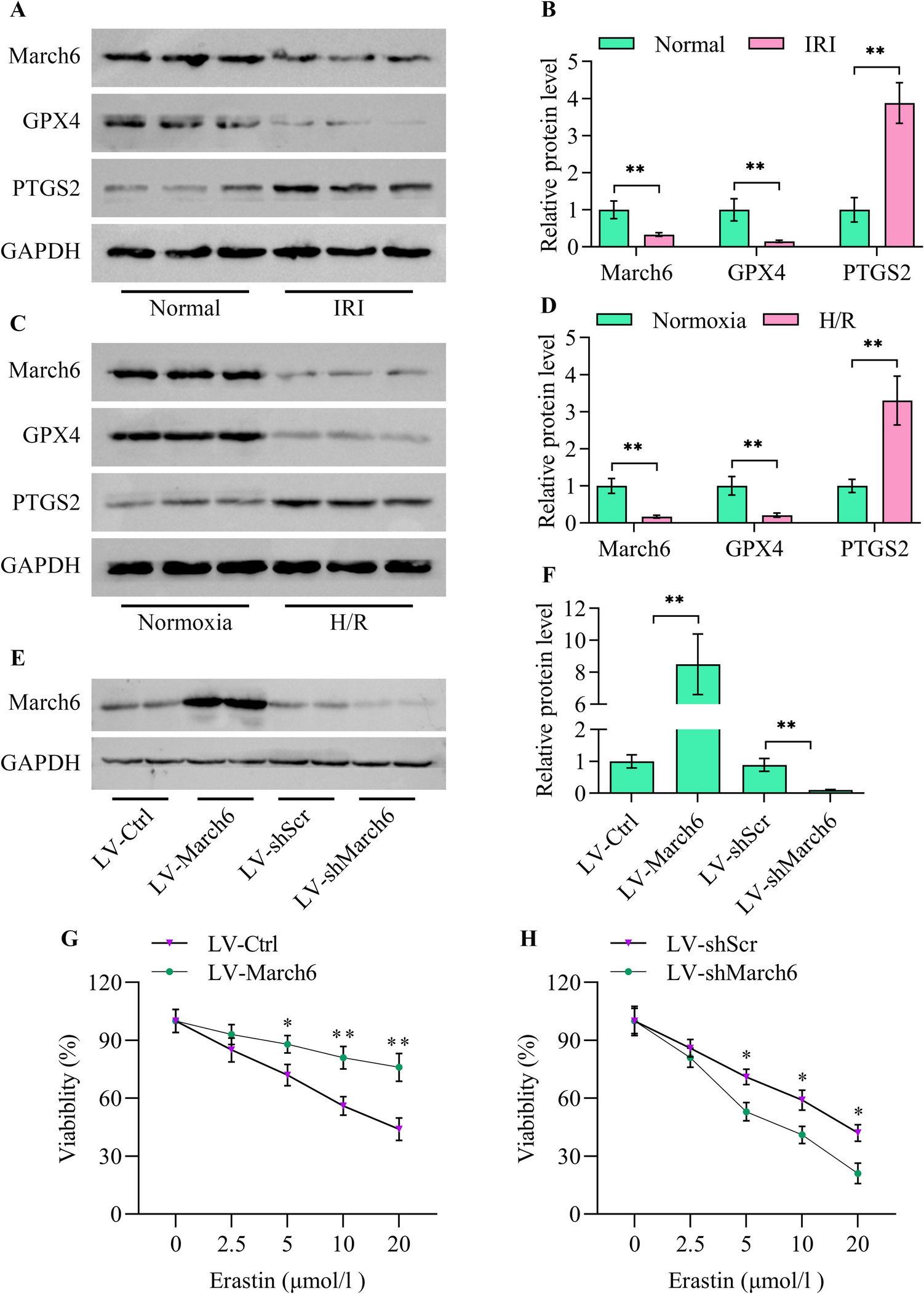 March6 Protects Against Acute Kidney Injury by Suppressing Renal Tubular Epithelial Cell Ferroptosis Through the Destabilization of P53 and ACSL4 Proteins