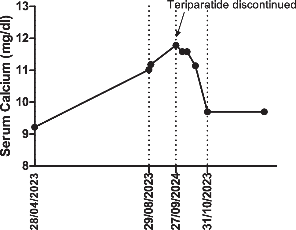 Prolonged hypercalcemia induced by teriparatide: a case report and literature review