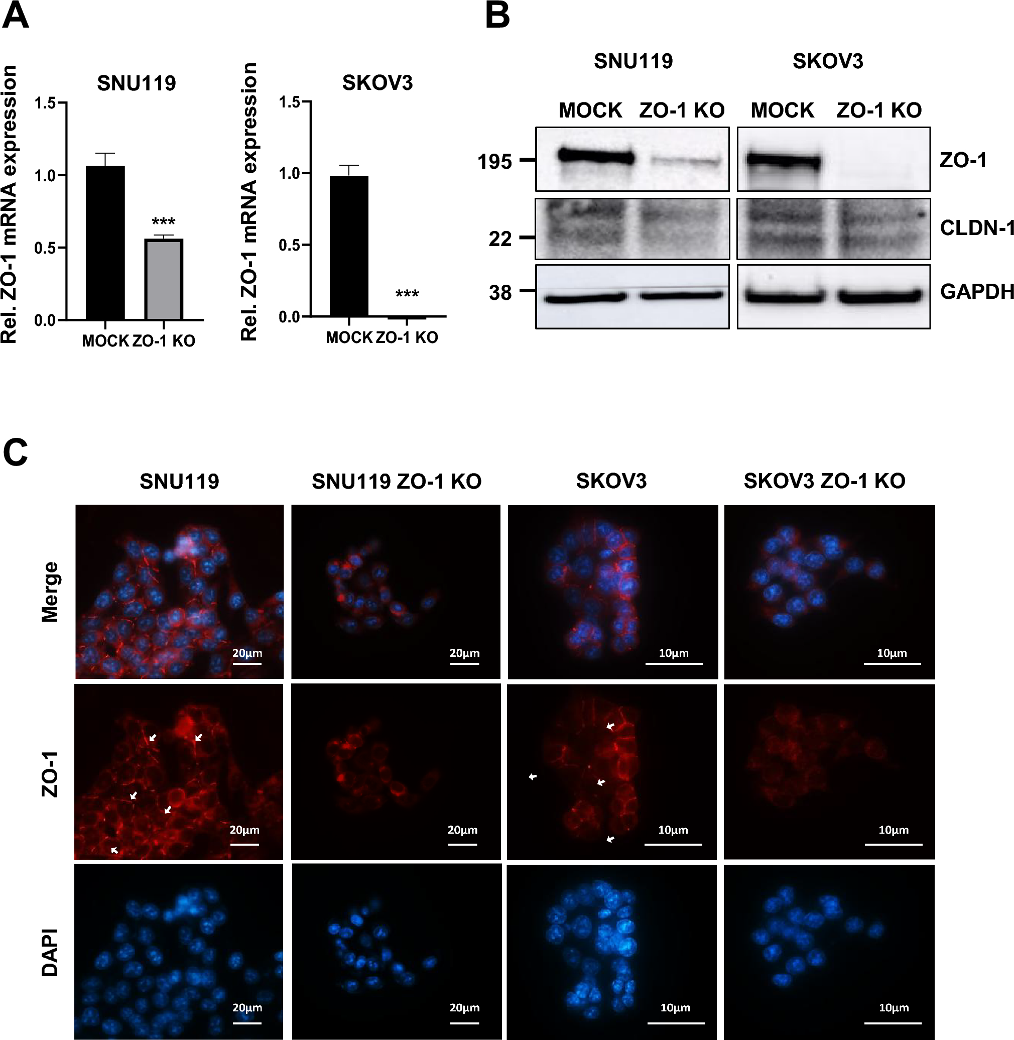 Effects of Zonula occludens-1 (ZO-1) tight junction protein on tumor characteristics in human ovarian cancer cells