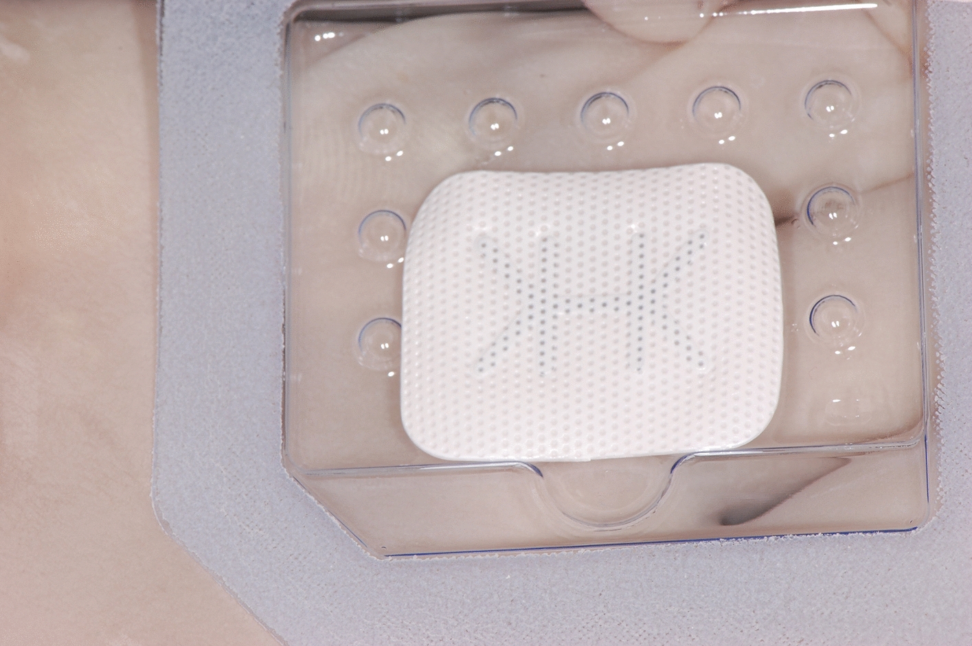 Barrier Membranes and Soft Tissue Substitutes in Implant Dentistry: A Focus on Biomaterial Type and Rationale for Use