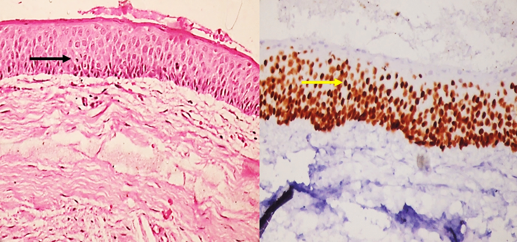 Exploring the Role of p63 in the Pathogenesis and Biological Behaviour of Odontogenic Cysts