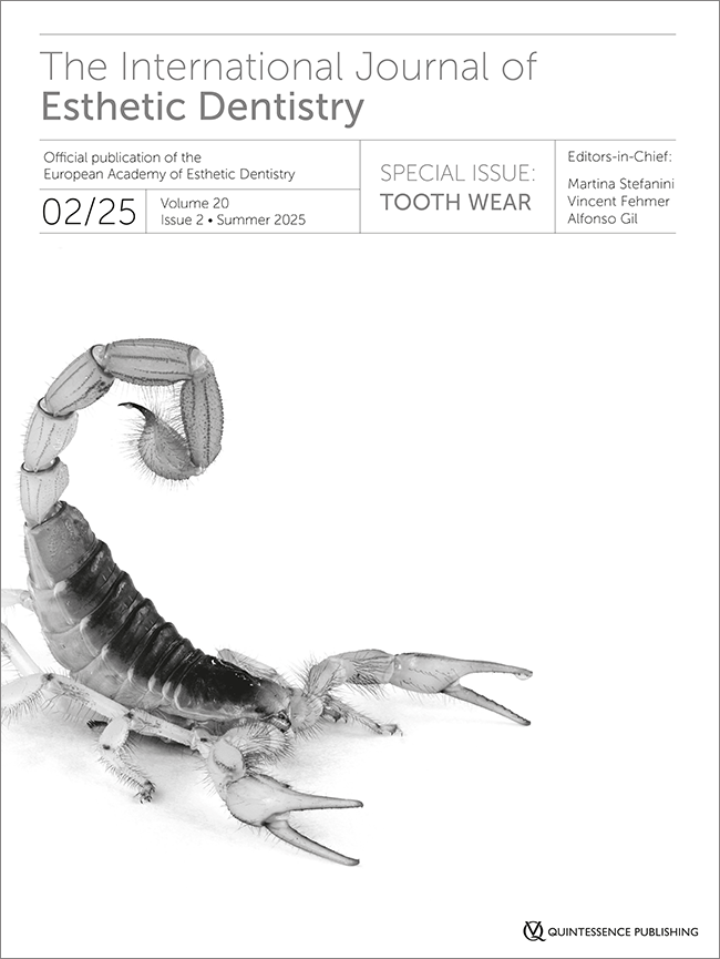 Rehabilitation of the worn dentition with glass-ceramic restorations