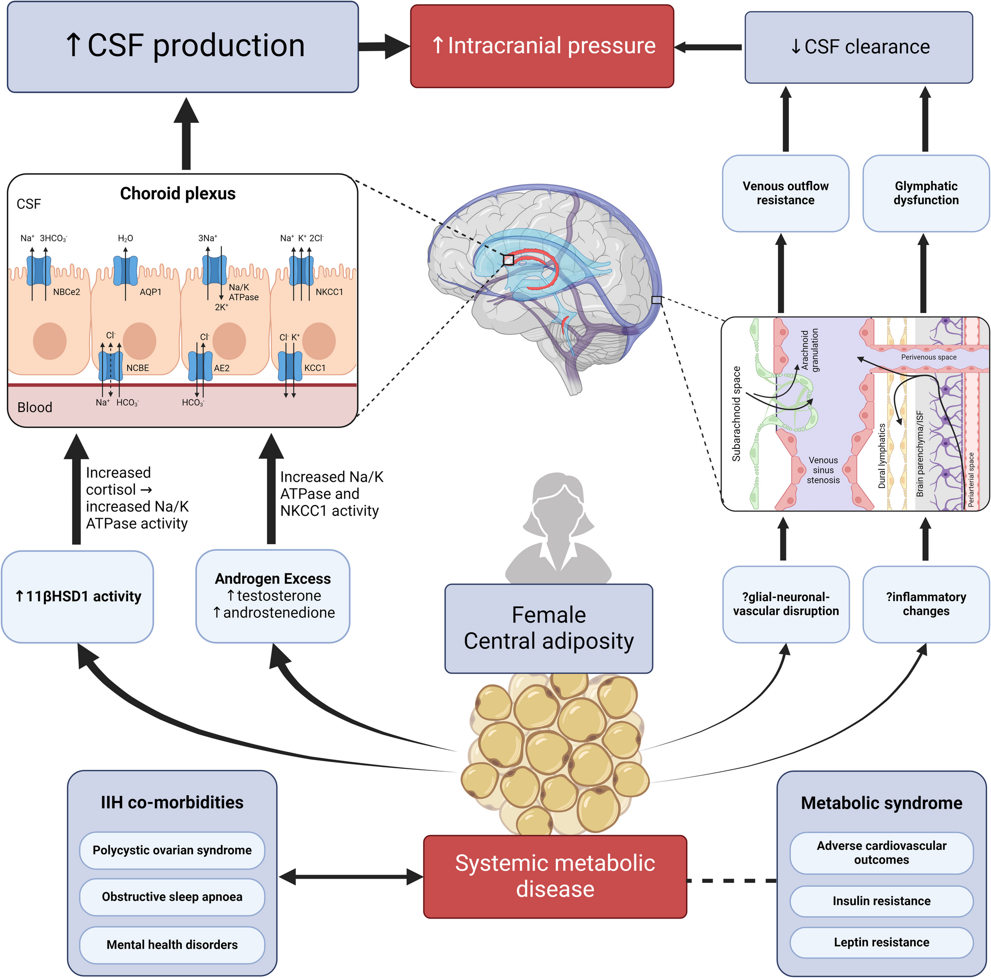 Current Understanding of the Pathophysiology of Idiopathic Intracranial Hypertension