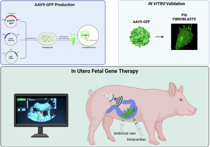 Transabdominal ultrasound guided AAV9-GFP delivery in fetal pigs: a translational and minimally invasive model for in utero fetal gene therapy