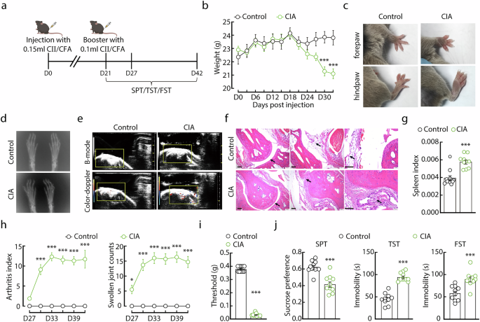 G-protein coupled receptor kinase 2 mediates rheumatoid arthritis-induced depression-like behaviors via the hippocampal CRHR1 signaling pathway