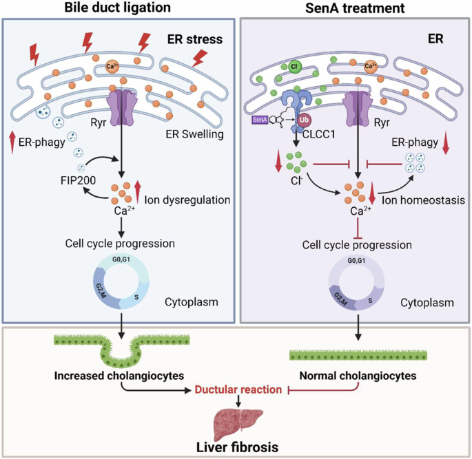 Senkyunolide A ameliorates cholestatic liver fibrosis by controlling CLCC1-mediated endoplasmic reticulum Ca2+ release