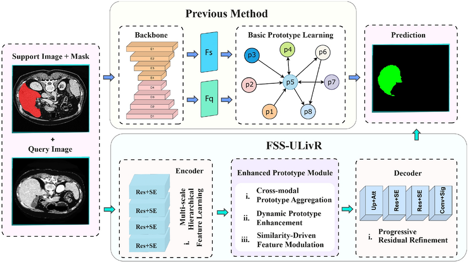 FSS-ULivR: a clinically-inspired few-shot segmentation framework for liver imaging using unified representations and attention mechanisms