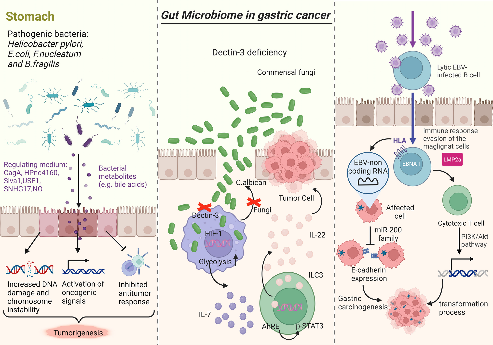 Gut microbiome and gastric cancer: microbial interactions and therapeutic potential